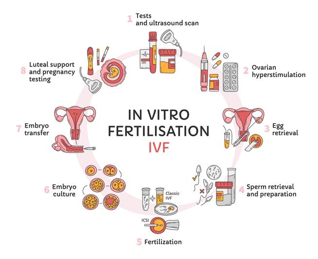 In Vitro fertilization IVF vector circle infographic, infertility treatment scheme. Ovarian hyperstimulation, artificial insemination, embryo culture, luteal support. Medical procedure for pregnancy